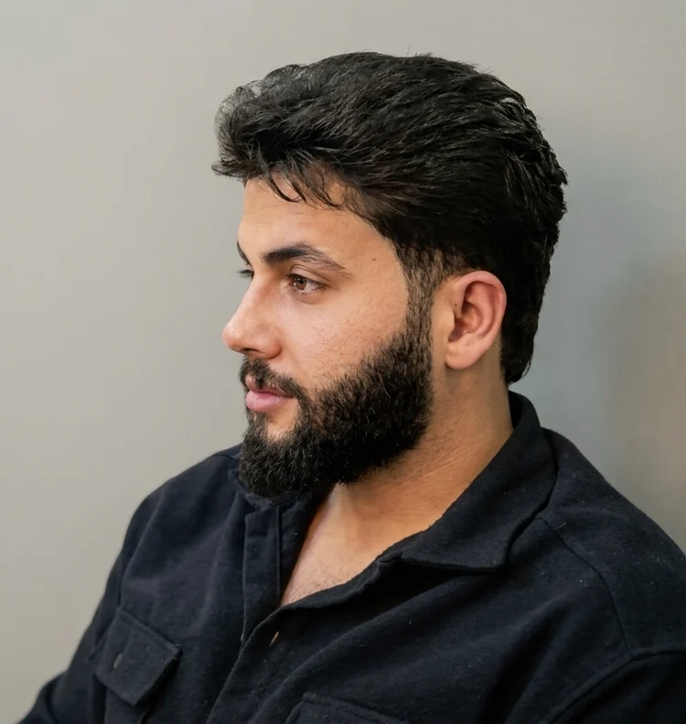 Patient six months after rhinoplasty, refined profile